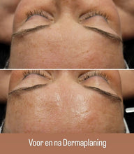 Load image into Gallery viewer, Dermaplaning Facial - La Maison de Marie Webshop