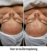 Load image into Gallery viewer, Dermaplaning Facial - La Maison de Marie Webshop