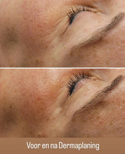 Load image into Gallery viewer, Dermaplaning Facial - La Maison de Marie Webshop