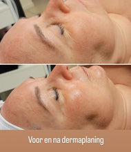 Load image into Gallery viewer, Dermaplaning Facial - La Maison de Marie Webshop