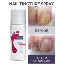 Load image into Gallery viewer, Footlogix Toe Nail Tincture 50ml
