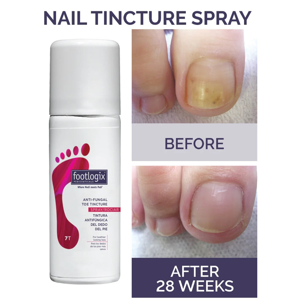 Footlogix Toe Nail Tincture 50ml