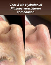 Load image into Gallery viewer, Hydrafacial Signature - La Maison de Marie Webshop
